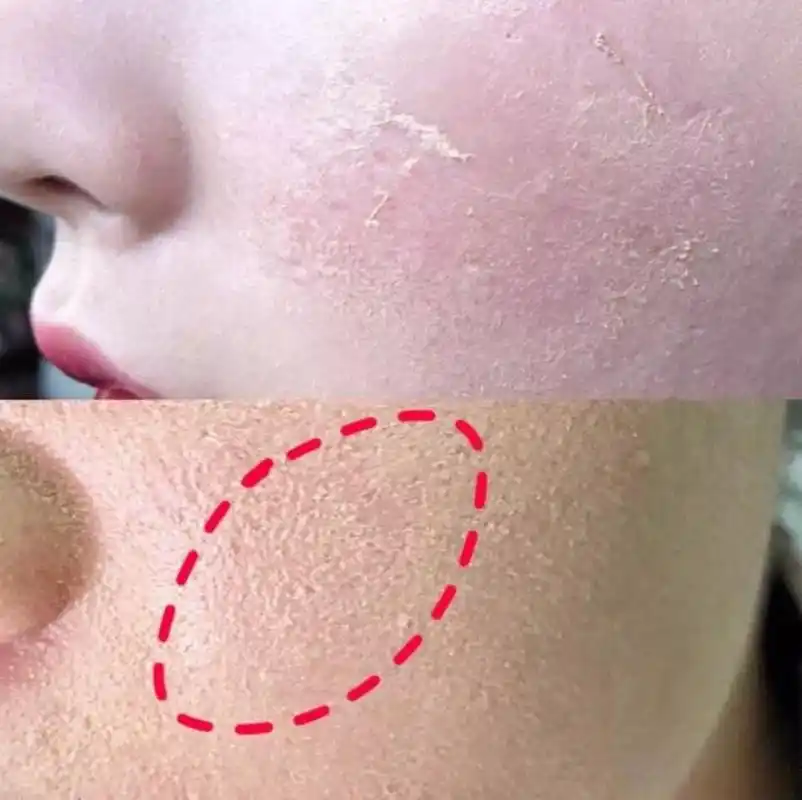 夏沫护肤老师皮肤暗沉粗糙没有光泽可能是这个原因