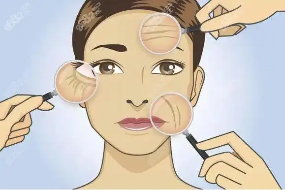 轮廓固定提升后期皮肤更松弛