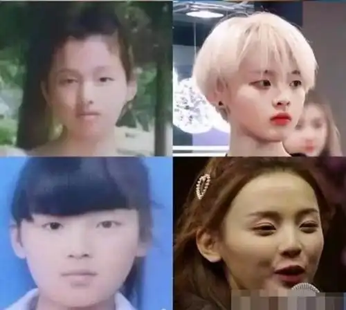 杨超越整容被曝出道之前长相差别大