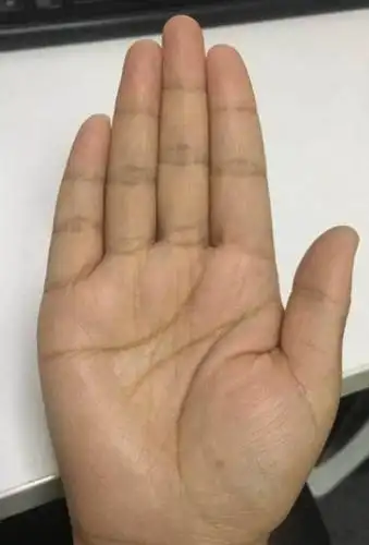 女子"苦命"手相,贫病交加,难享夫福,没人疼爱孤苦无助!