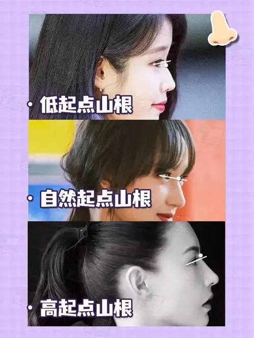 感觉好多人没搞清楚塌是证明看鼻梁宽,侧面看鼻梁塌,iu显然不是鼻梁塌