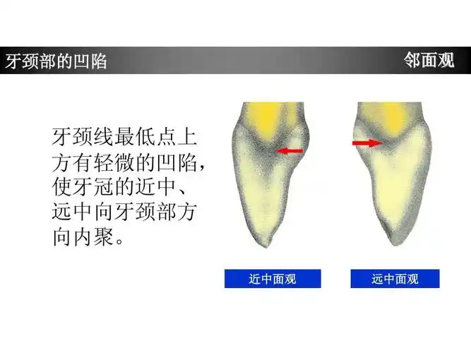 上颌中切牙形态特征简述ppt