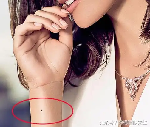 手腕上长痣代表什么手腕有痣命运图解