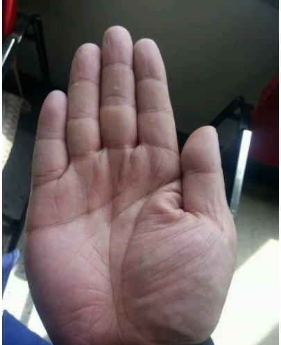 手相那个神乎其神的通天纹竟然长这样