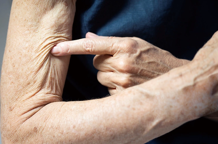 足,皮脂腺分泌不足,减肥及偏食等原因,老年人皮肤新陈代谢能力就会变
