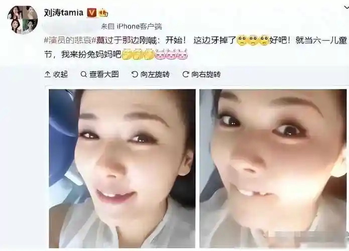 刘涛一口蓝牙上热搜,网传值300万,网友调侃:这牙能连接音响_文章_牙齿