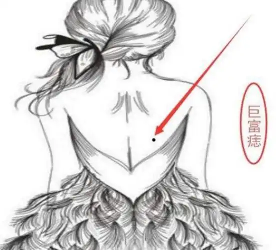 痣相:长在后背的六大富痣,有哪些喻意(图)