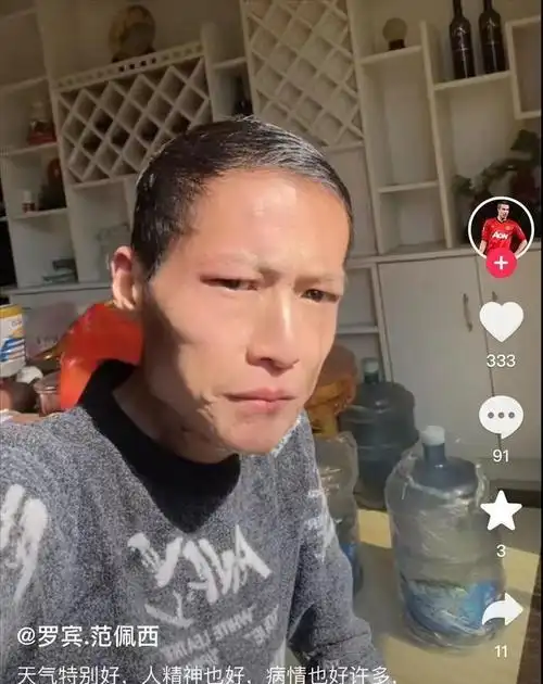 "槟榔四巨头":一天吃5包槟榔,两年死仨,剩下一个割舌保命|苏醒|彬彬