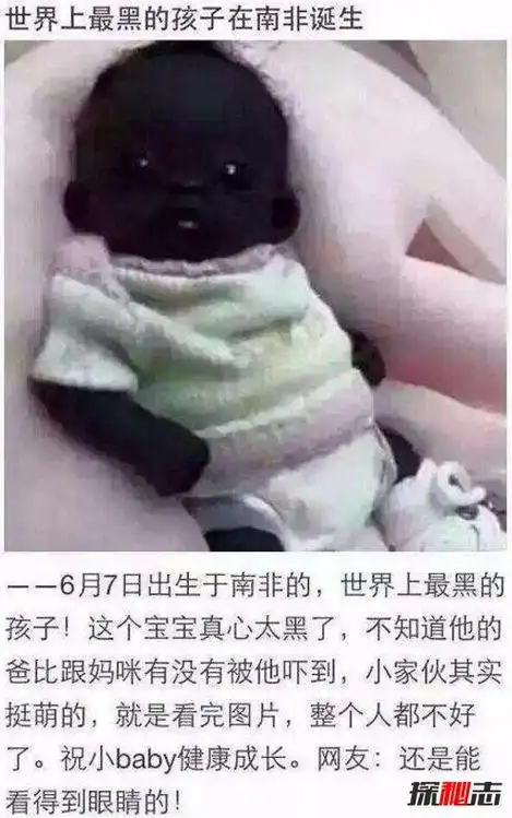 世界上最黑的孩子,眼珠都黑成碳了(长大图片曝光)
