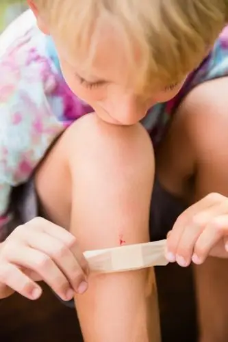 4. 用带药的创可贴,小心过敏.