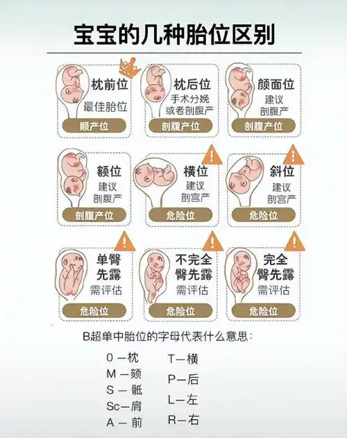 胎盘|子宫|胎心|顺产|宝宝|胎儿畸形_网易订阅
