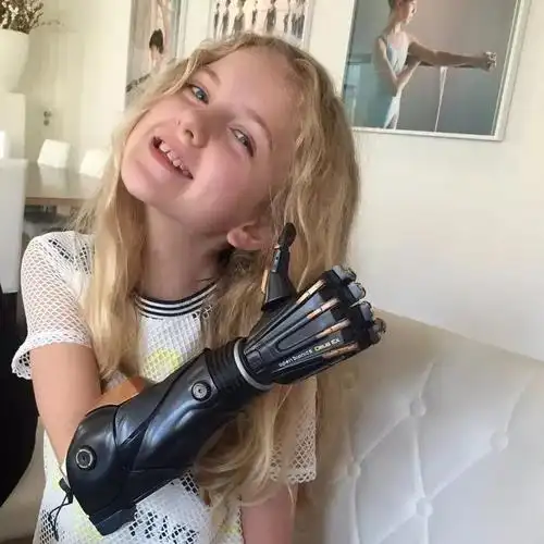 获得了tilly手臂的建模数据,从而最大程度地提升了新假肢与手臂的匹配