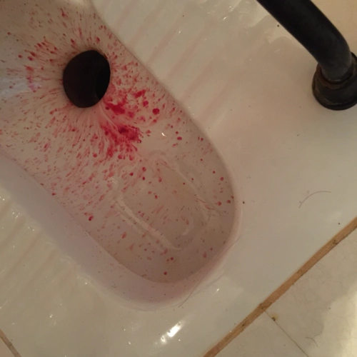 为什么我见红会流那么多血,正常吗?