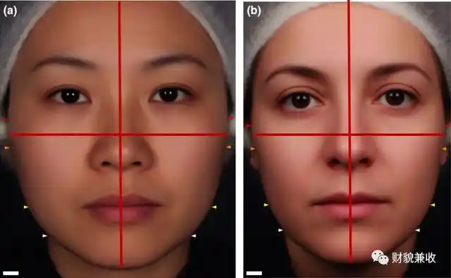 多半呈内收状态,而亚洲人的颧骨相比欧美人更宽,且颧弓部分更容易外扩