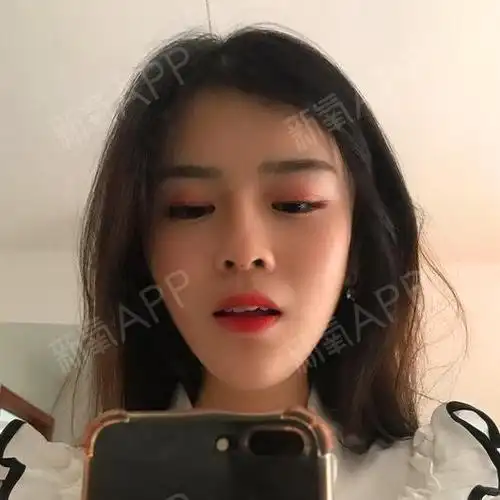 哈喽,各位氧宝们,在李氏整形做的玻尿酸垫鼻子,第七_圈子-新氧美容