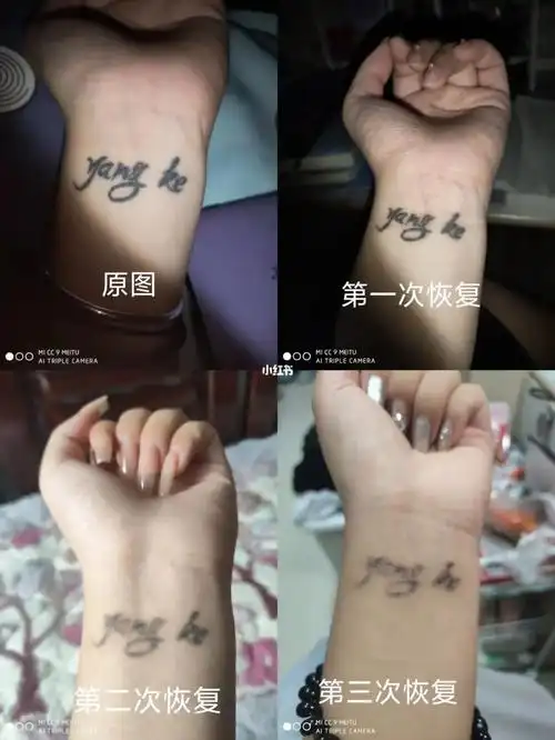 洗纹身三次对比