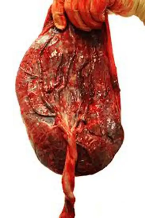 人胎盘详细的特征图片