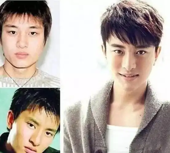 男明星整容前后对比黄晓明原来以前长这样