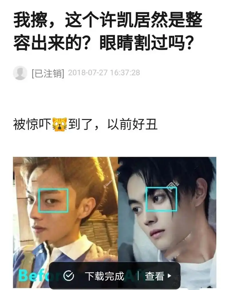 原创许凯究竟有没有整容双眼皮是揉出来的童年照一出答案自然来了