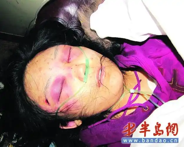 女子遍体鳞伤被弃路边 目击者称是被人推下车