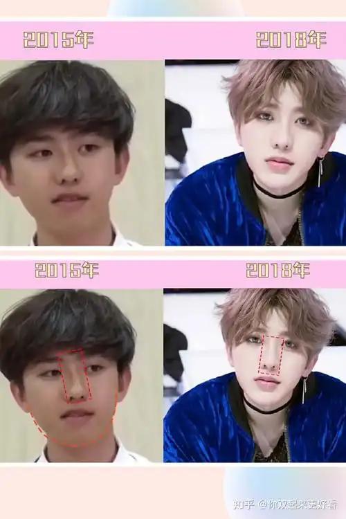 然后就有人贴出了他在15年参加另一档节目的照片~说蔡徐坤的眼睛,鼻子