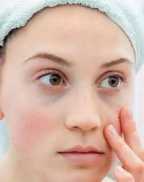 在线等,熬夜脸垮还能救吗?