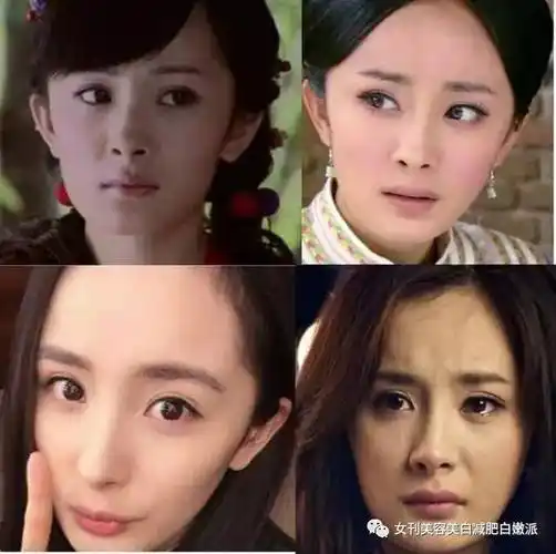 杨幂的双眼皮怎么这样了!整残了还是贴坏了?