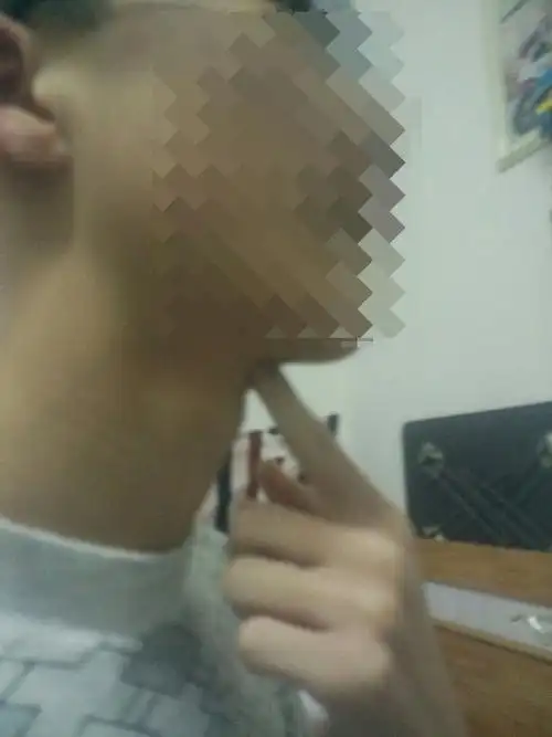 请帮我看看我喉结是不是有问题,今天同学说我喉结大的出奇,平常没在意