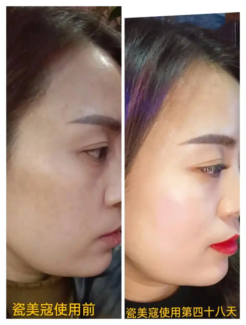 真实的样子,没有对比就没有伤害!#瓷美寇美白淡斑提亮肤色 - 抖音