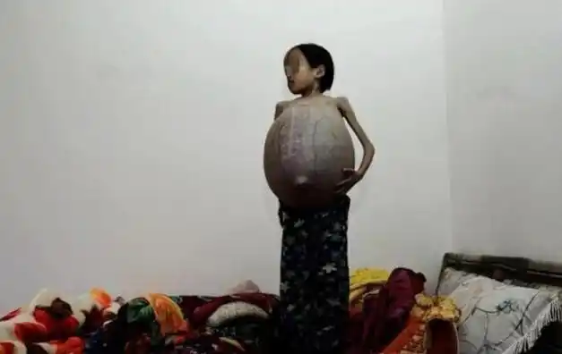 12岁的小女孩,对她的第一印象,你很可能会只注意到她那像怀孕十月的