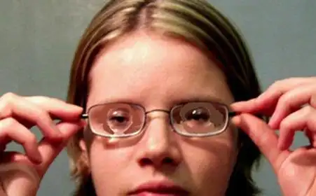 高度近视眼怎么矫正