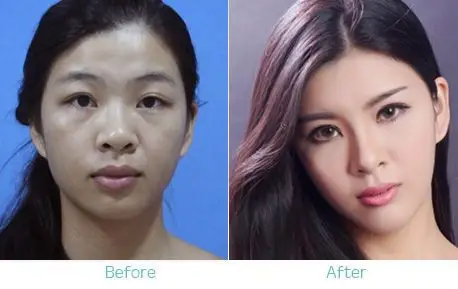 美白针对比案例