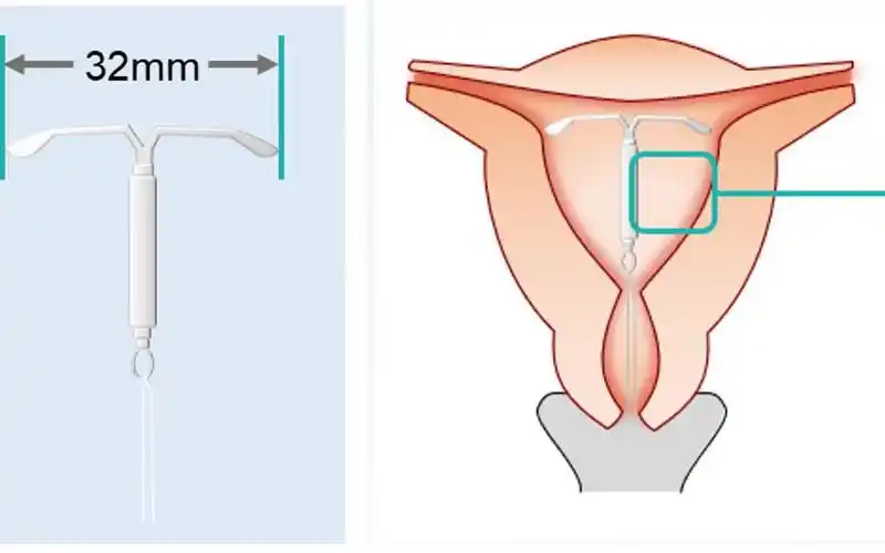 从材质形状图片3分钟清楚曼月乐环是什么样子