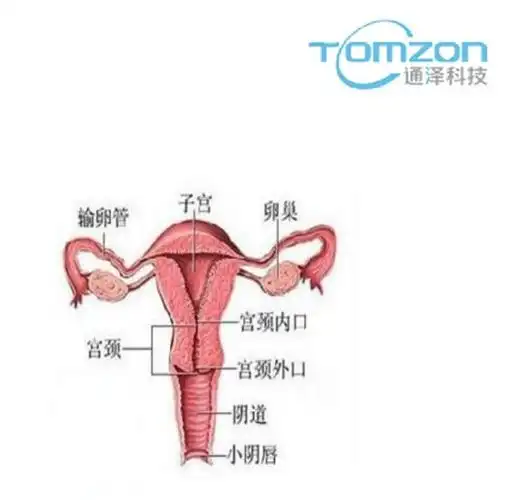 关注产后女性健康子宫修复仪器的重要性