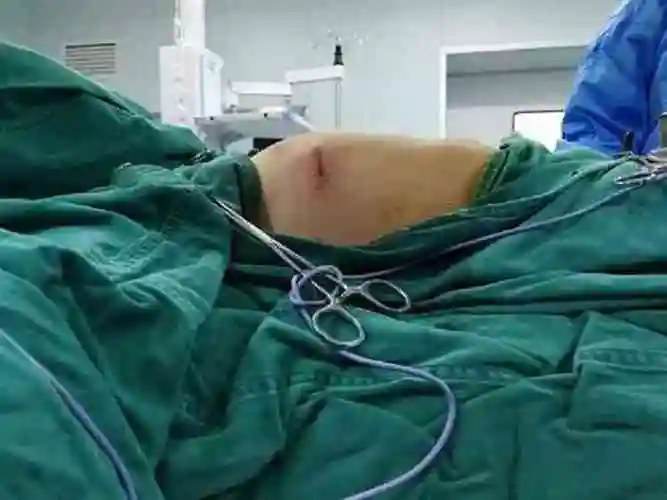 一岁宝宝鸡胸长什么样能分享几张图片吗