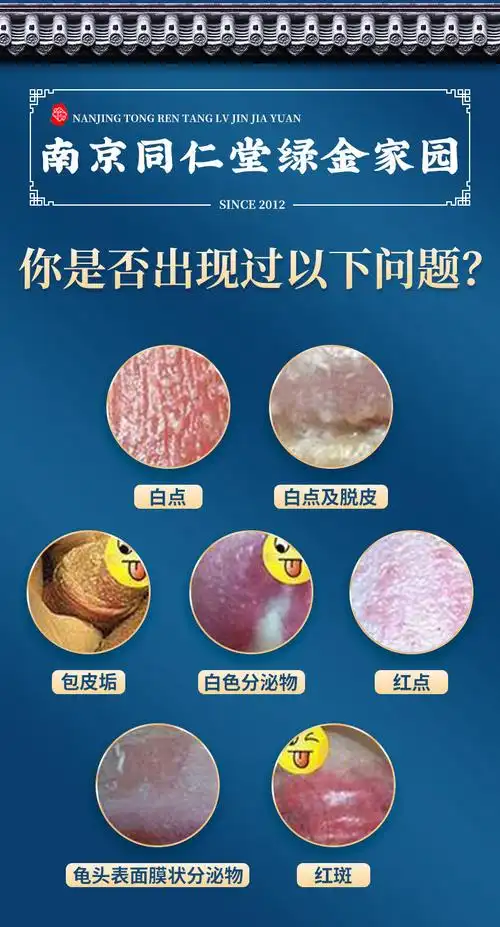 【南京同仁堂】男性炎包皮霉菌阴囊瘙痒潮湿红肿异味私处护理 喷剂