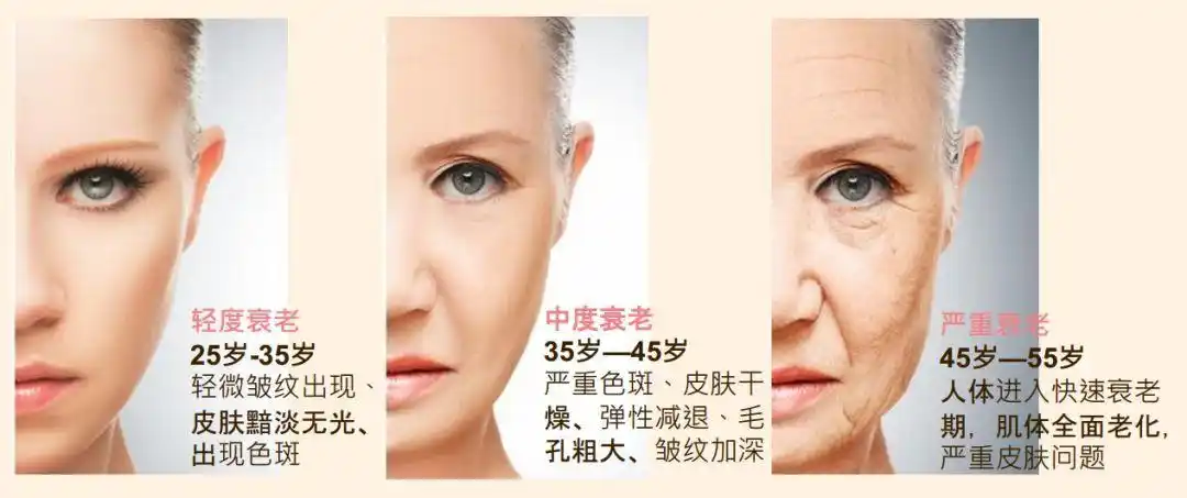 受不同的生活环境,人种特点和生活方式等因素的影响,人们出现衰老迹象