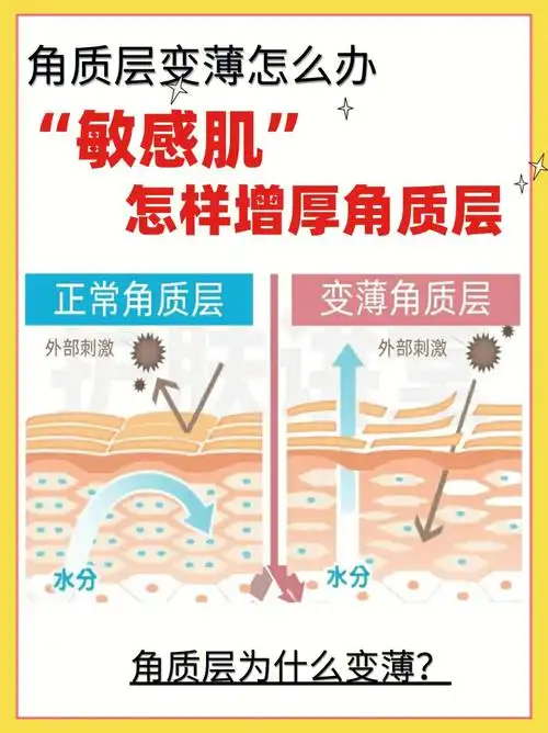 角质层变薄怎么办71敏感肌怎样增厚角质层