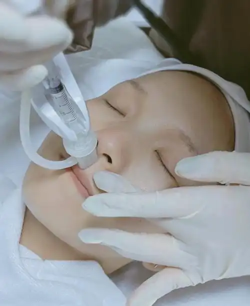 打水光针,又称微针美容注射术,是一种通过微细针头在皮肤表面穿刺注入
