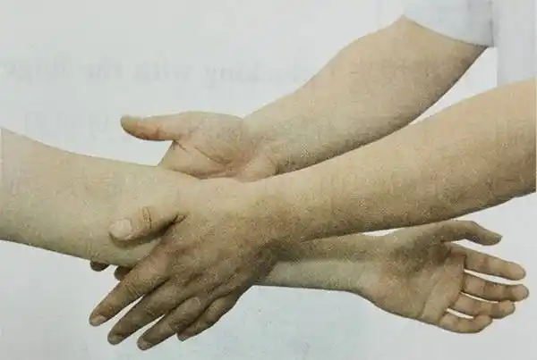 跟我学推拿 | 推拿结束前再搓一搓,行气活血又舒筋通络-搜狐