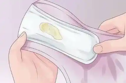 白带如果在身体正常情况下,量是比较少的,但是排卵期的白带量会比较多