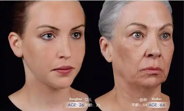 年轻与衰老的巨大差异这对母女告诉你
