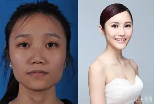 网曝多女子整容前后对比照令网友大开眼界