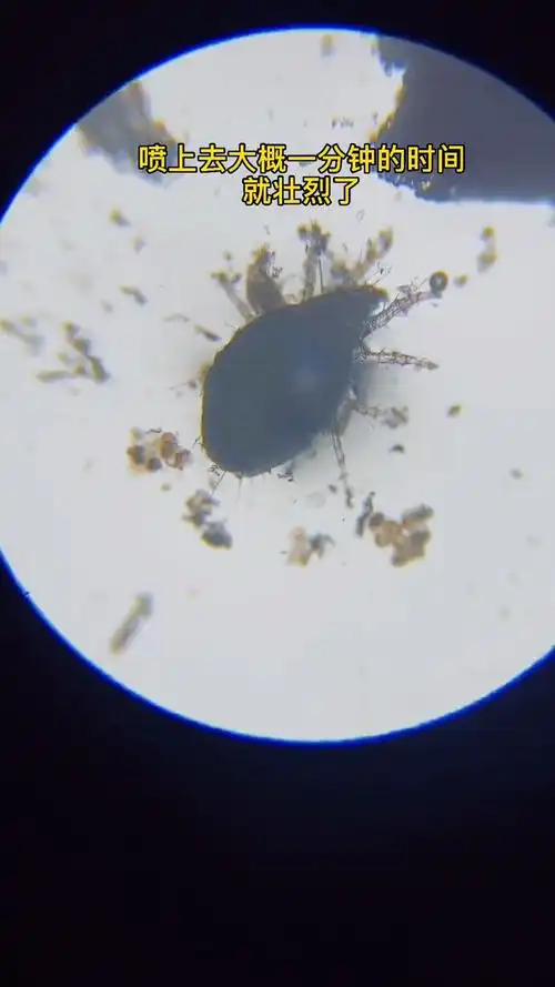 显微镜放大200倍后的夏天螨虫,你说吓人不