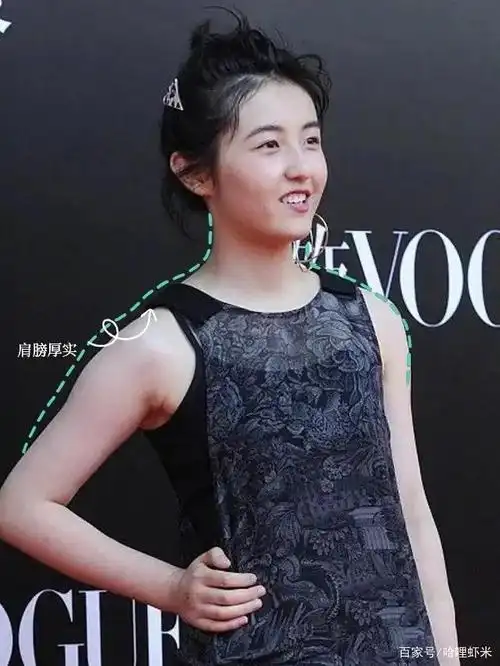 斜方肌对于气质的影响有多大?