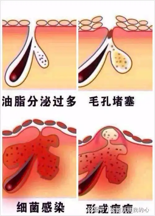 皮肤好不好,取决于身体好不好,脸油不要总怪护肤品