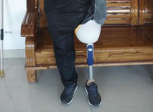 大腿假肢的安装有哪些注意事项