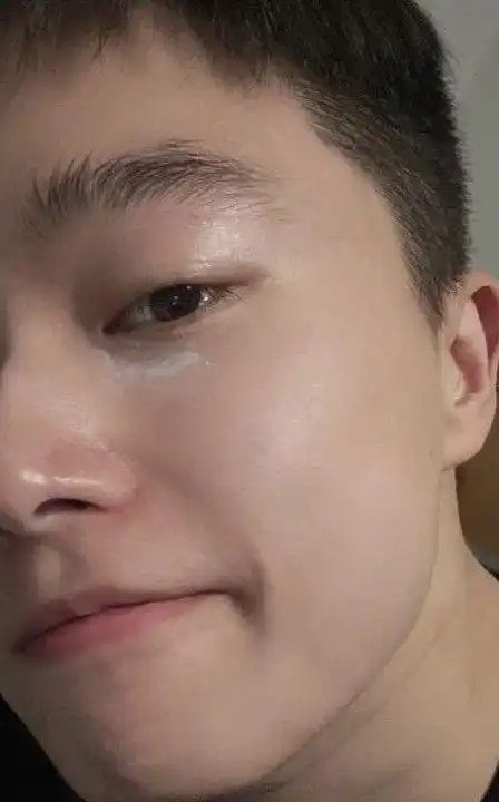 男生如何养成一张干净的脸毛孔粗大痘痘反复黑头问题的解决方法男士