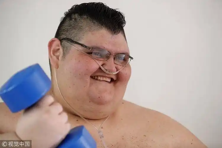 pedro franco)是世界上最重的人,体重达到595公斤