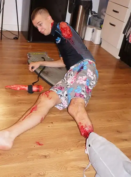 截肢者的幽默:残缺也可以很美